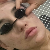 blakeblossomfree Desnuda