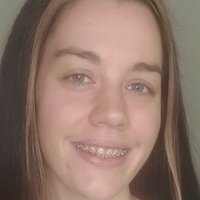 bracefacefree Desnuda